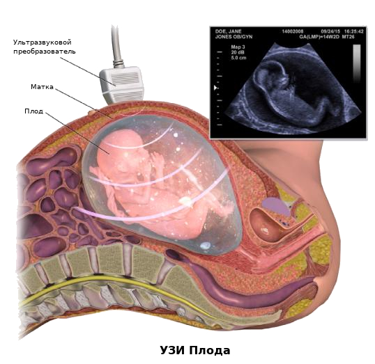 УЗИ плода